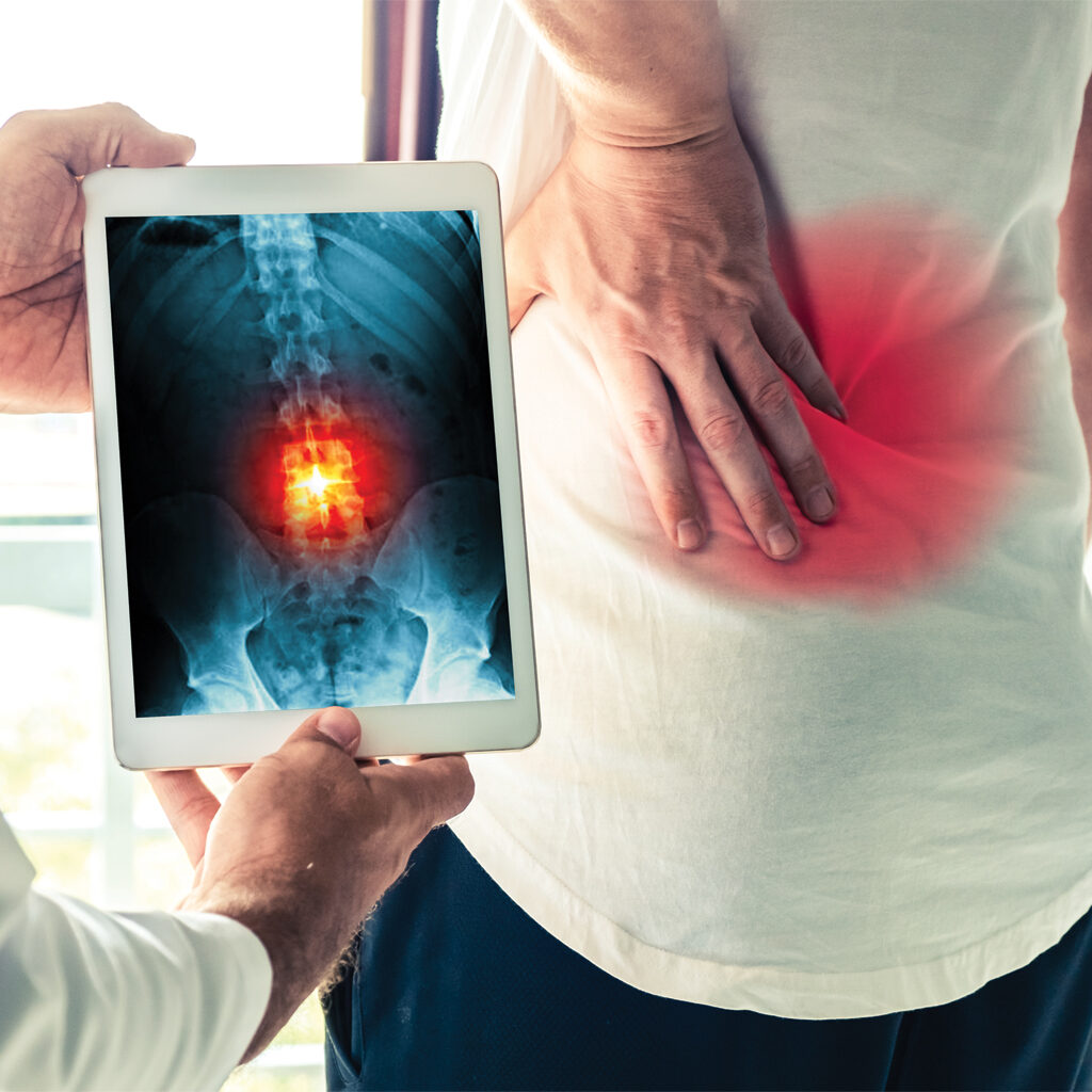 back pain treatment in Florida, USA
