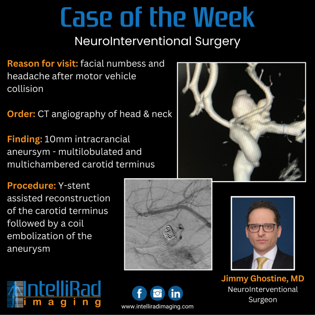 Case of the Week - Motor Vehicle Collision Patient gets Neurointerventional surgery