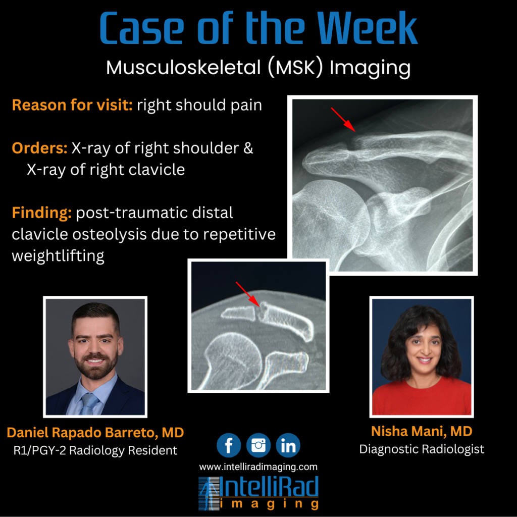 Case of the Week - This case features a rare diagnosis!