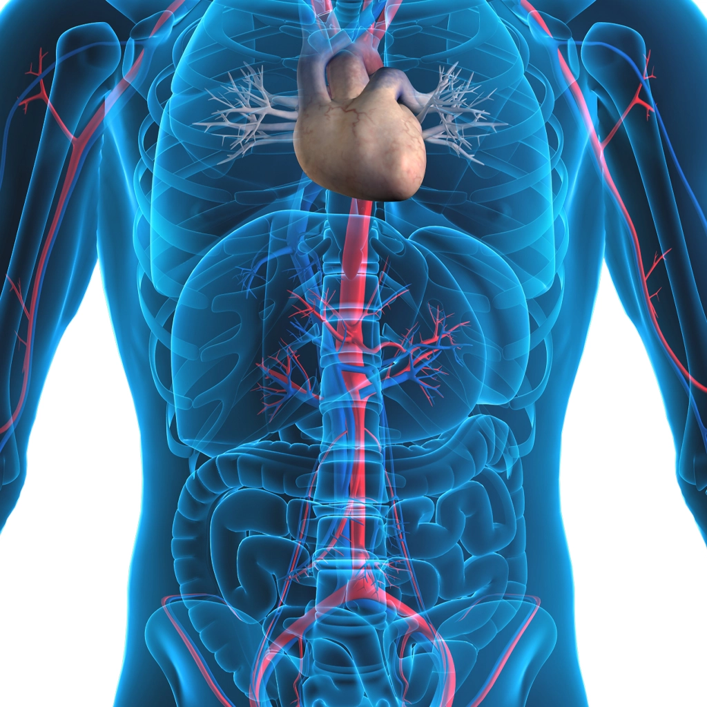 Abdominal Aortic Aneurysm